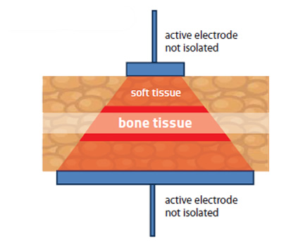 resistive mode