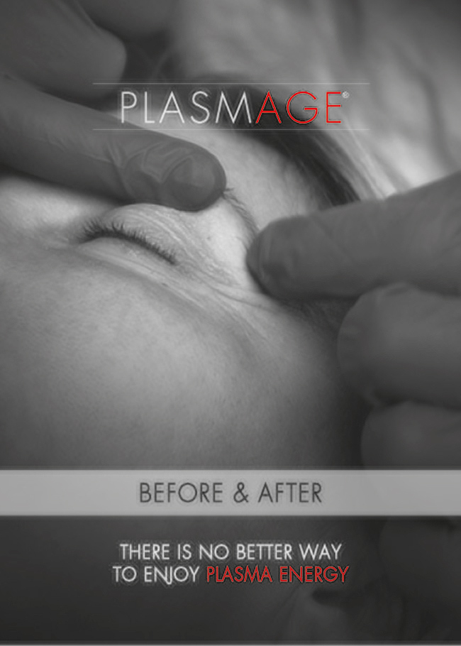 Plasmage Before After Treatments